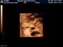 Vivian Sonograms